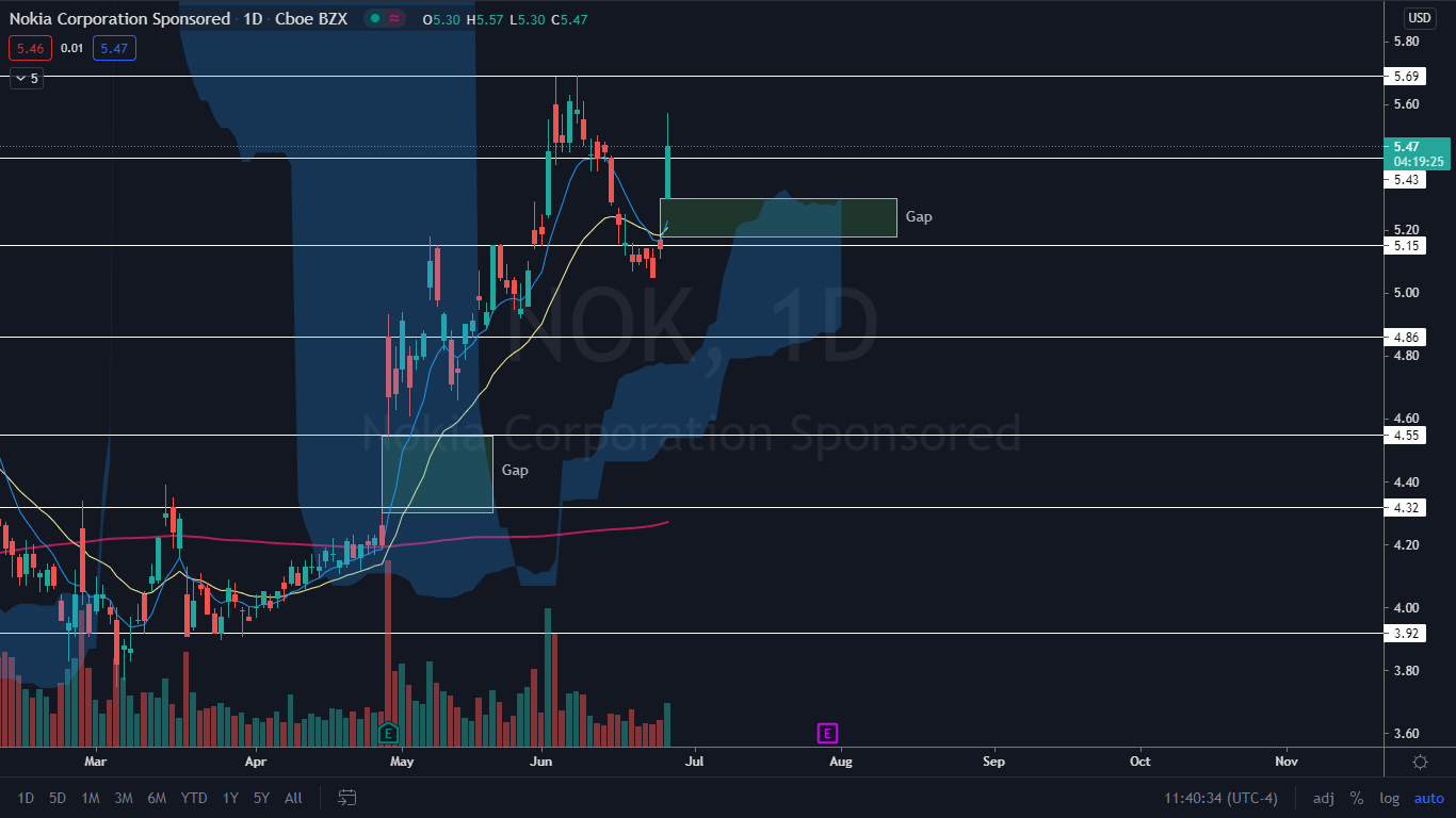 nokia stock forecast reddit